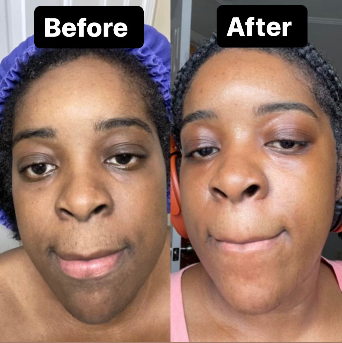 GLOW FACE KIT