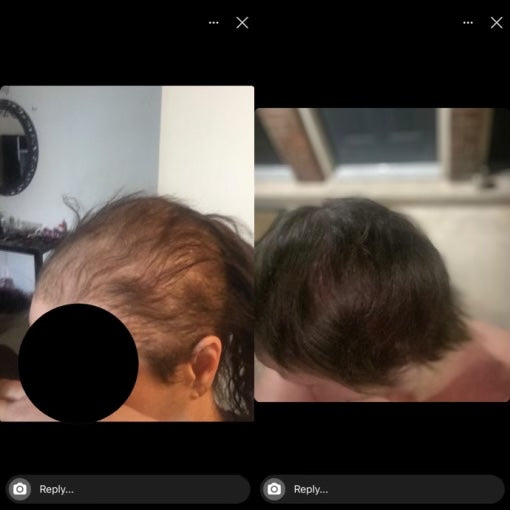 Customer Results Photos